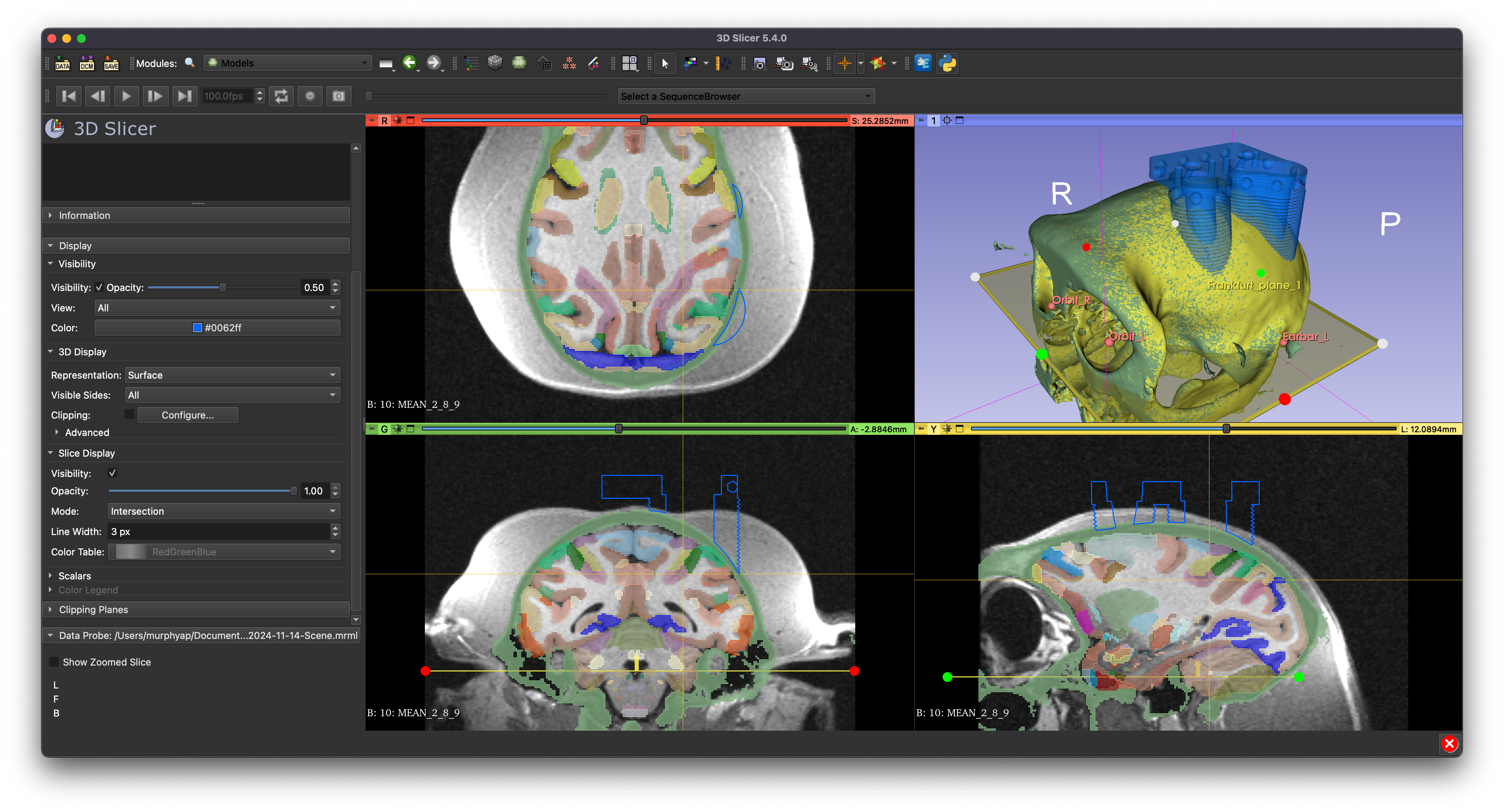_images/Slicer_ExampleChamber.png